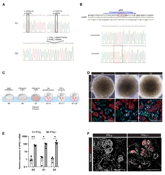 APOL1 iPSC肾类器官构建流程