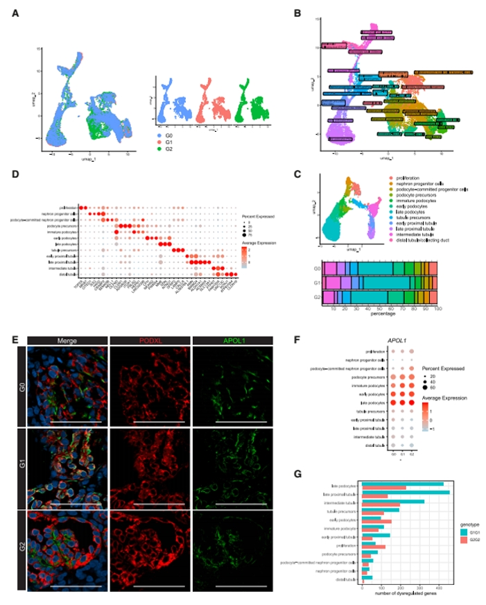 APOL1细胞定位与转录失调分析
