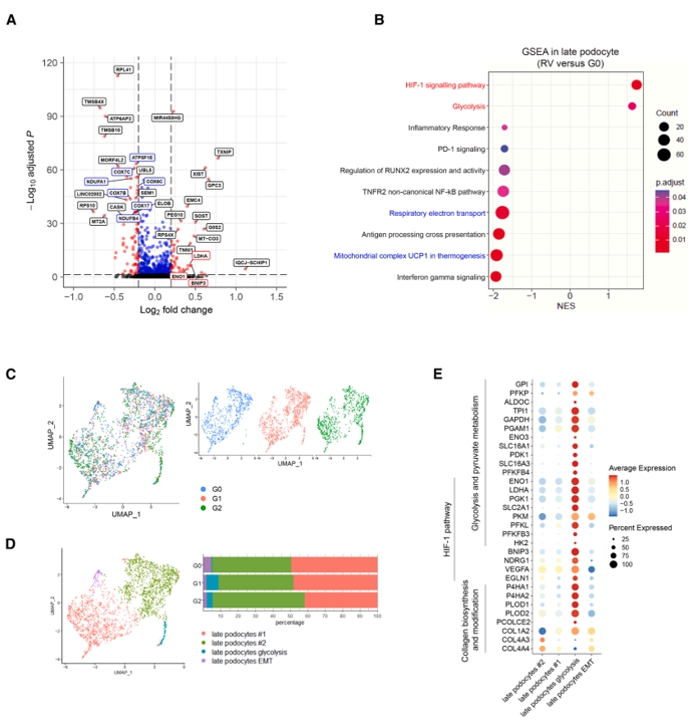 APOL1诱导足细胞代谢重编程