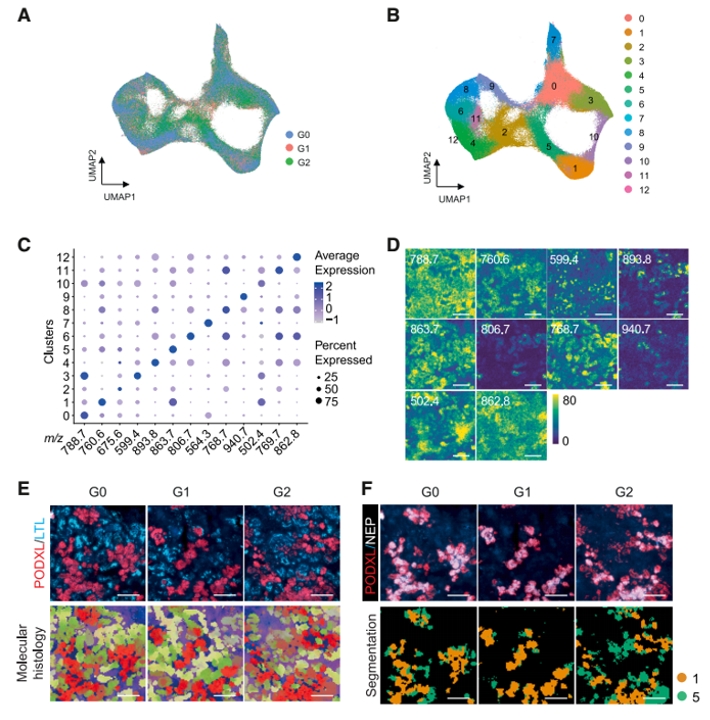 空间脂质组学定位成熟足细胞
