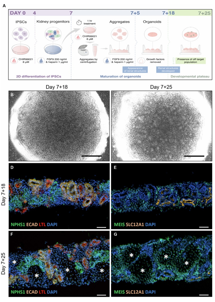 肾类器官的分化培养流程及形态学与结构变化