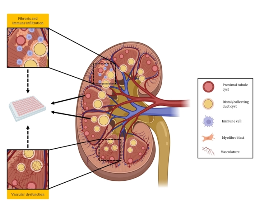 图2：ADPKD主要病理特征和体外建模