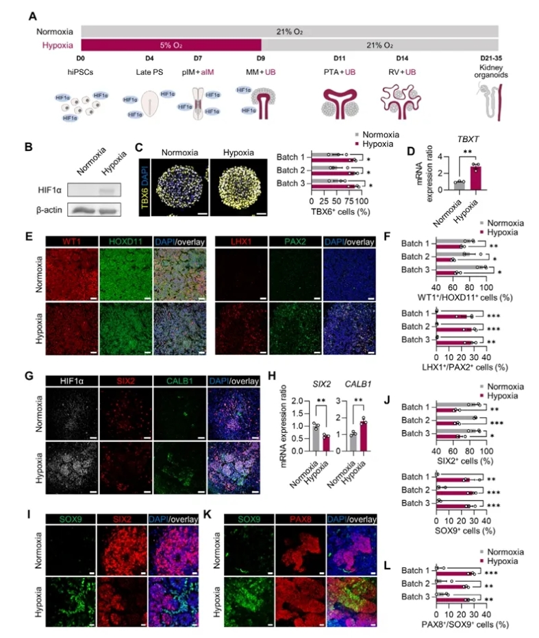 图1 缺氧诱导hiPSCs生成MM与UB-like细胞
