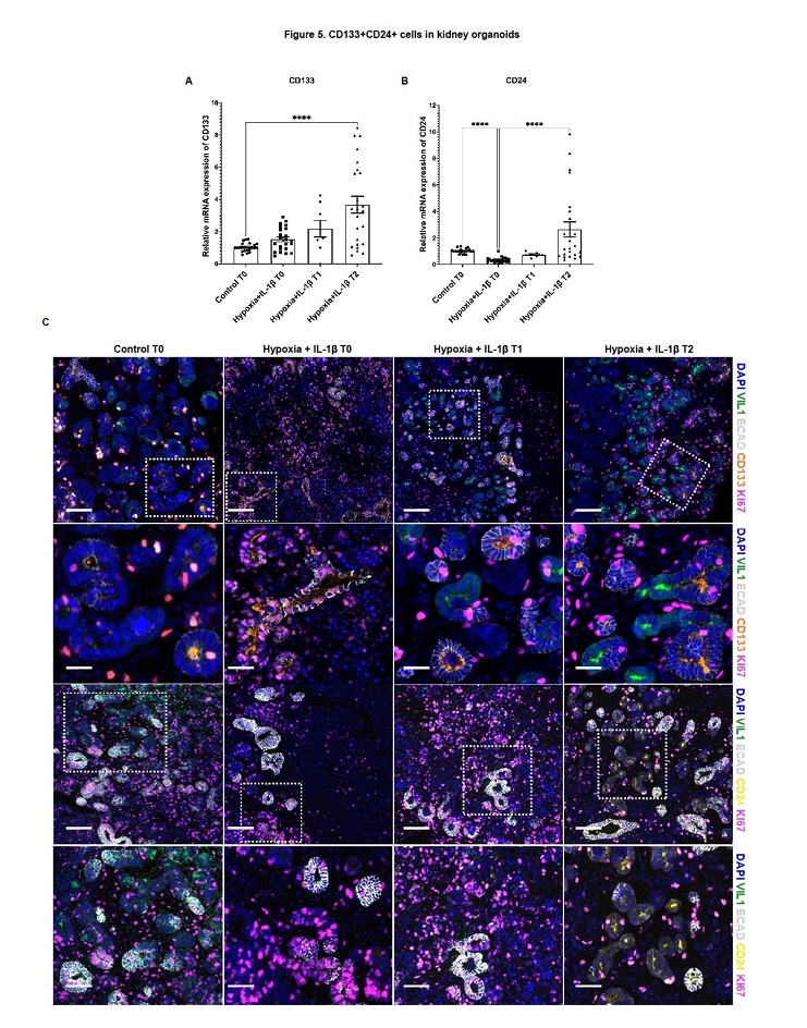 肾类器官损伤后CD133+和CD24+祖细胞样细胞群变化