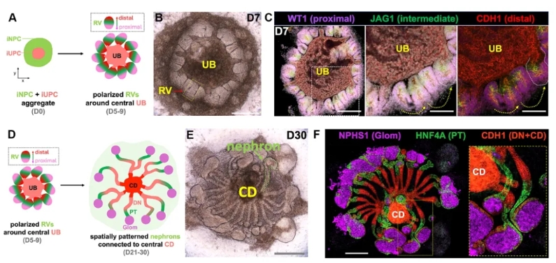 hKPA发育过程示意图