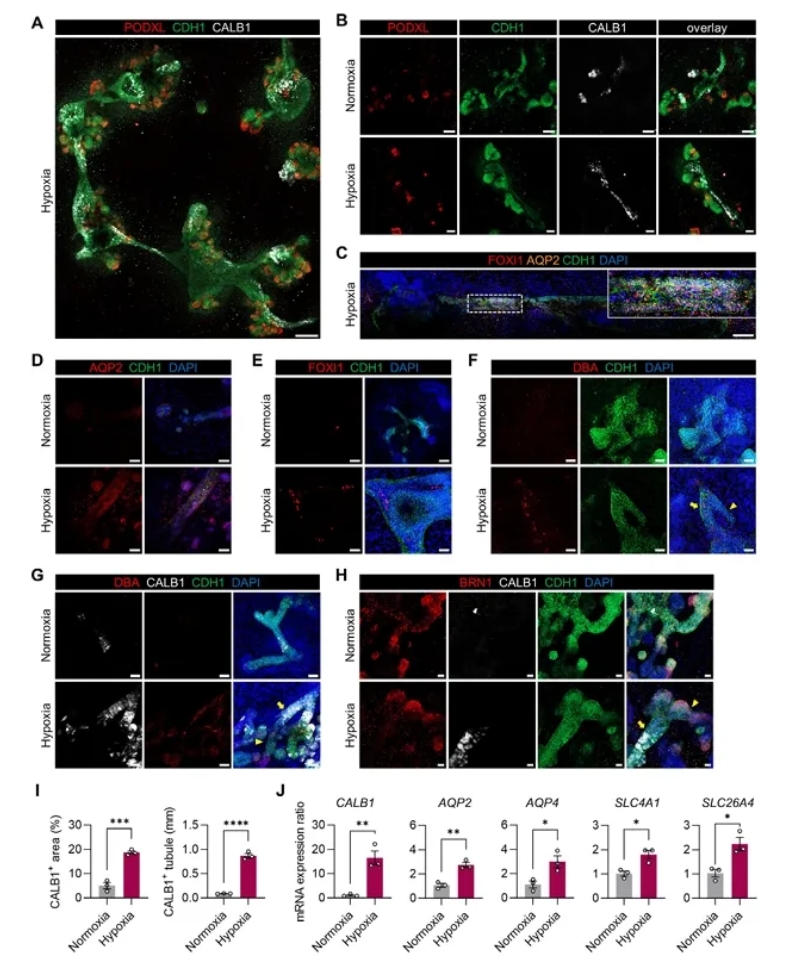 图3 缺氧肾类器官的集合管亚型细胞