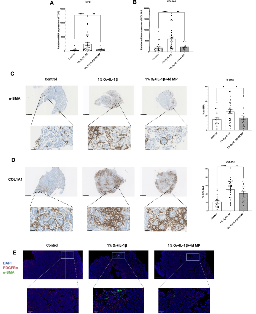 图5：MP抑制肾类器官纤维化
