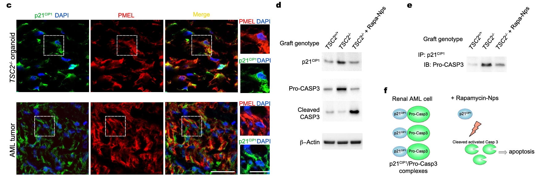 雷帕霉素纳米颗粒在体内破坏TSC2−/−类器官AML细胞中p21CIP1与pro-CASP3的相互作用