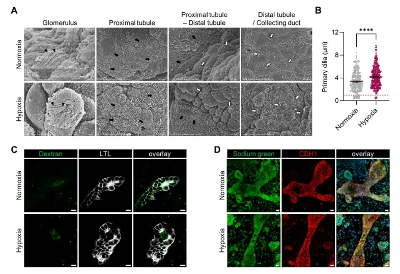图5 缺氧肾类器官的超微结构与功能