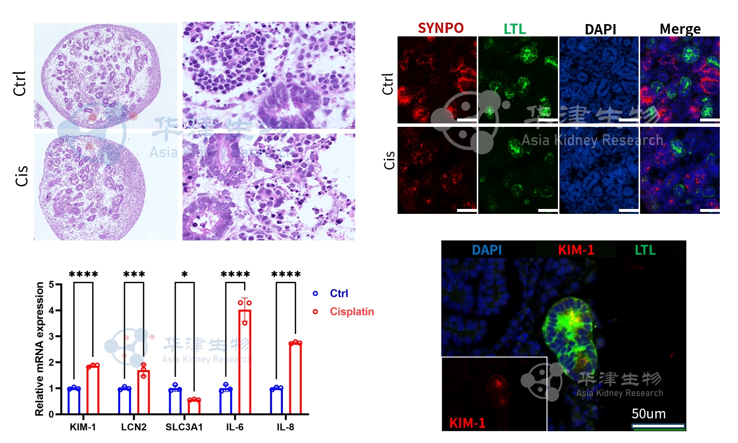 顺铂诱导急性肾小管损伤示意图