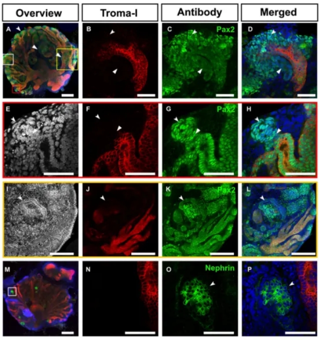 drMM与UB结合重建发育能力