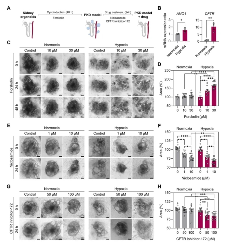 图7 缺氧肾类器官在PKD建模与药物测试中的应用