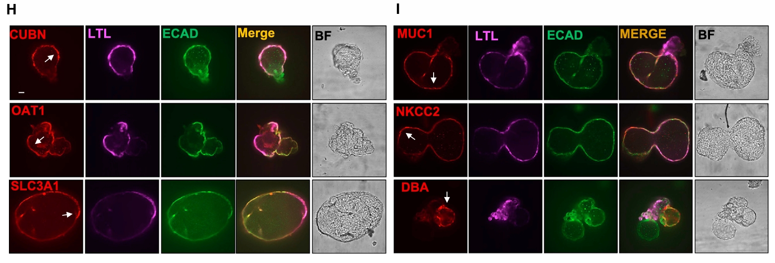携带纯合无义突变的肾脏类器官模拟多囊肾病表型