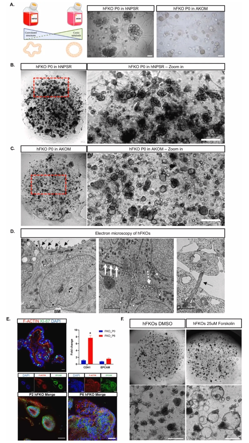 人胎肾类器官（hFKO）在不同培养基中的表型