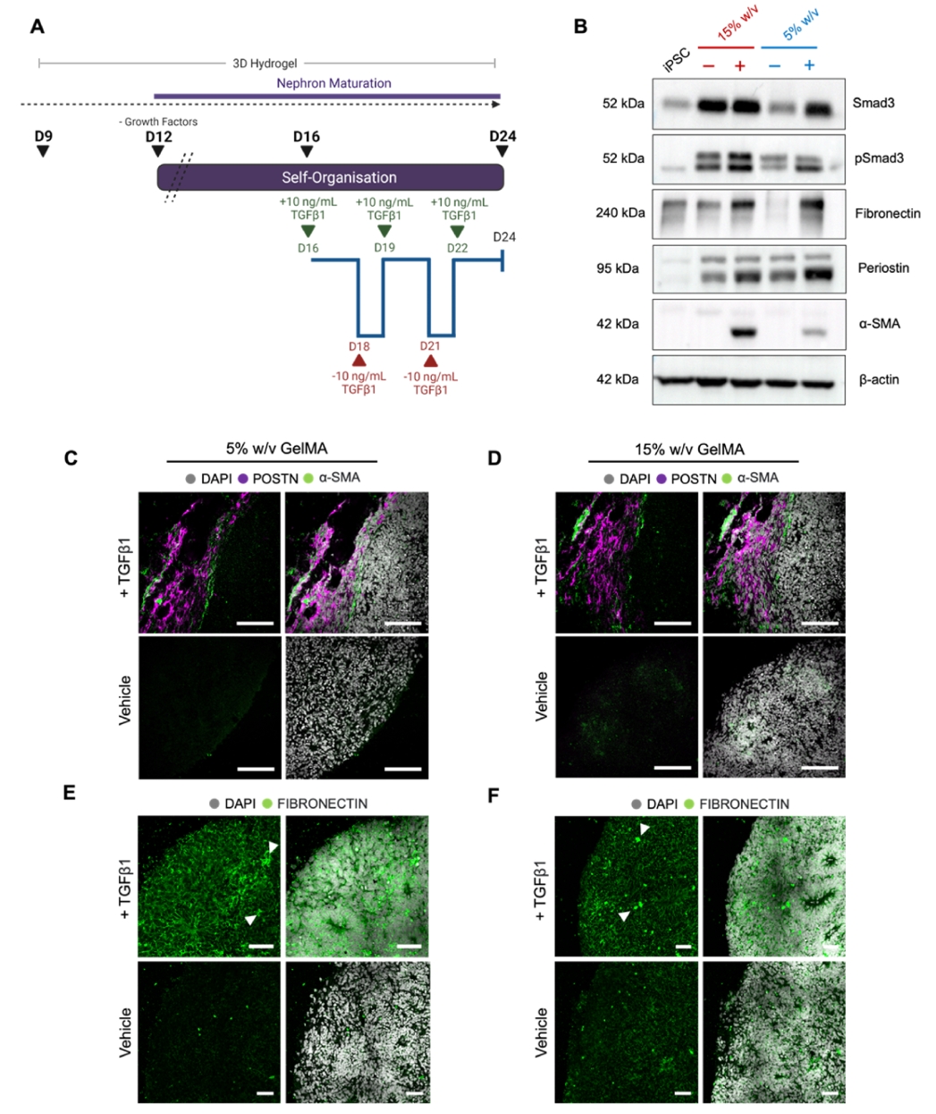 基质刚度对肾纤维化模型的影响