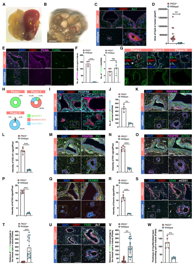 PKD模型与野生型对比