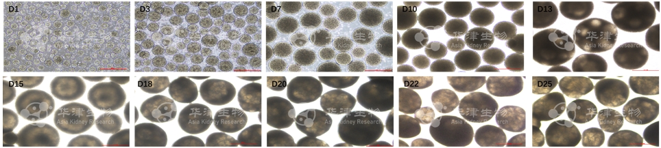 肾脏类器官明场图