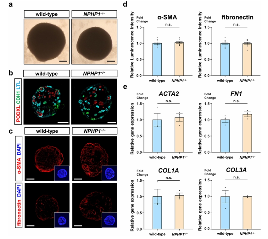 NPHP1⁻/⁻肾类器官基础特征