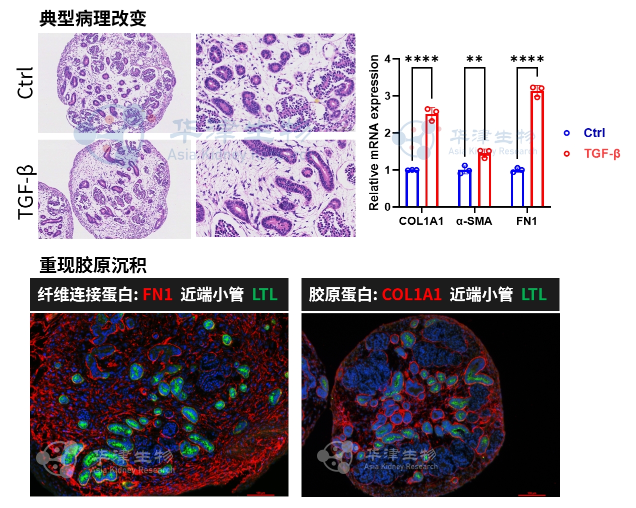TGF-β诱导肾类器官上皮-间质转化示意图