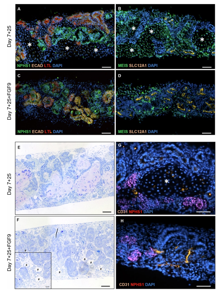 FGF9处理维持并增强肾类器官肾脏结构与血管化特征
