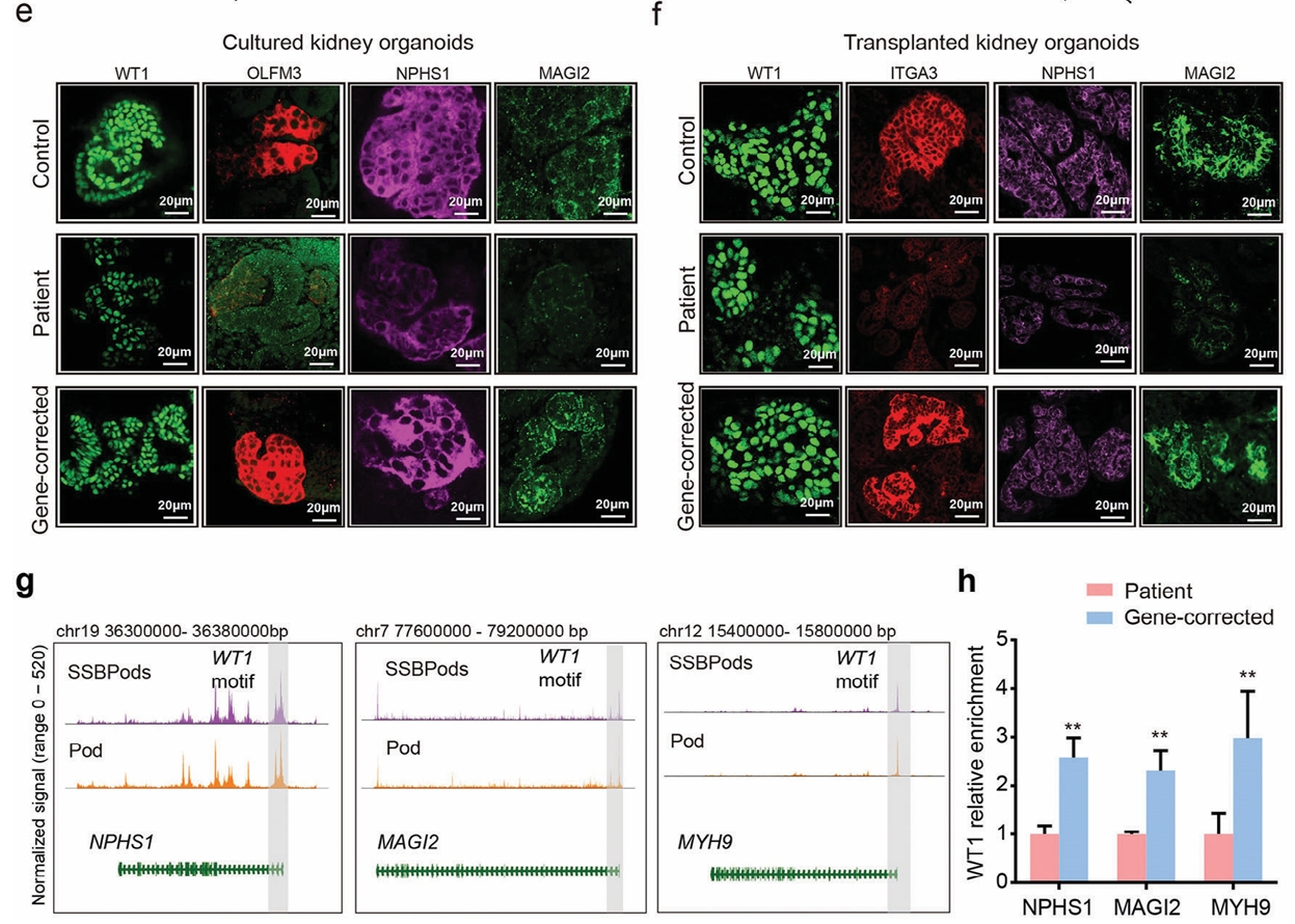 CRISPR/Cas9基因编辑纠正WT1突变恢复足细胞表型