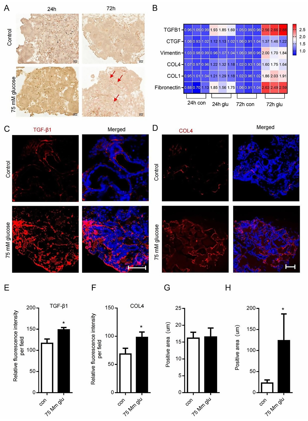 高糖诱导类器官纤维化