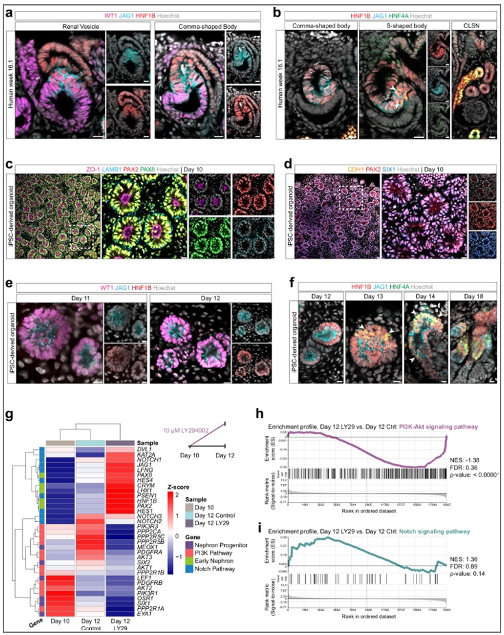 图1：HNF4A分布与PI3K抑制通路分析