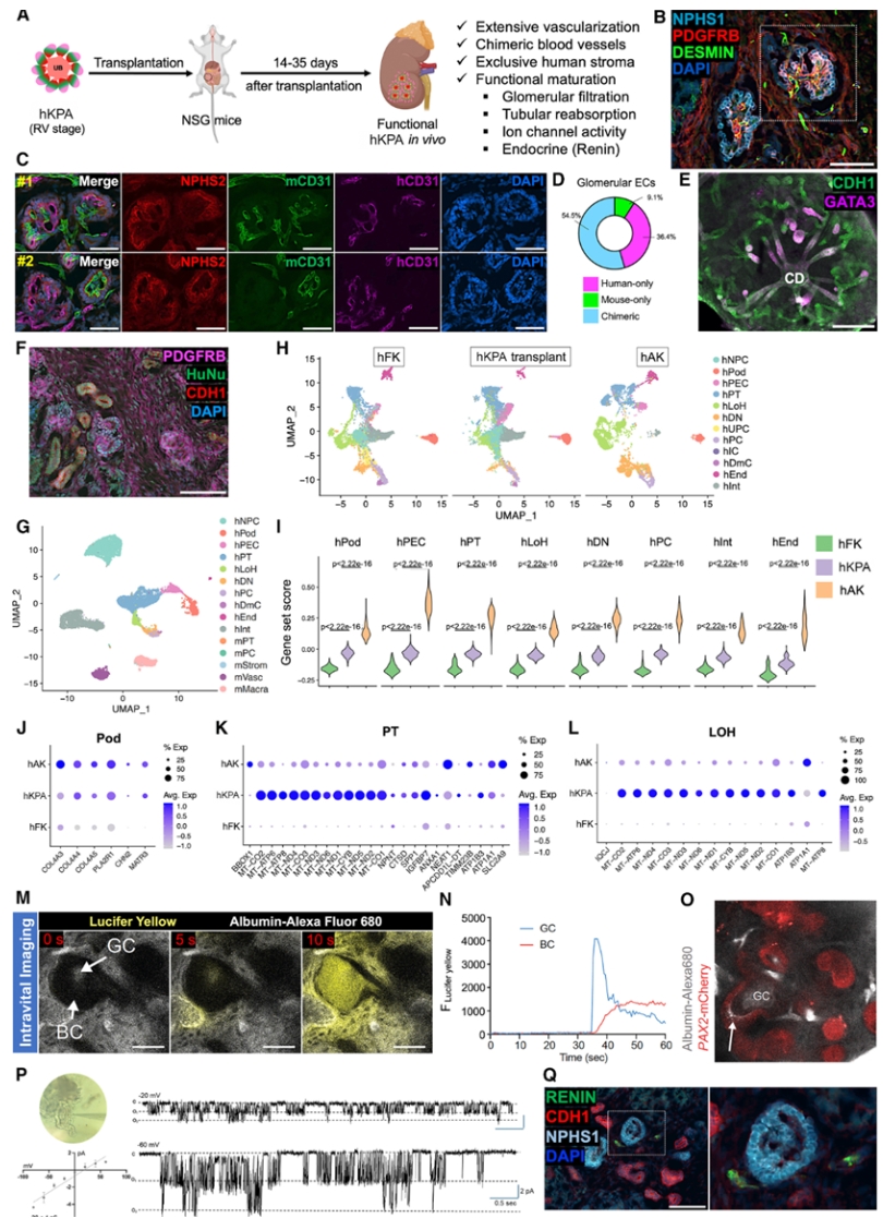 hKPA移植小鼠示意图