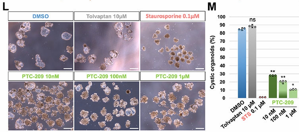 基因编辑肾祖细胞的多囊肾病模型构建及小分子化合物筛选