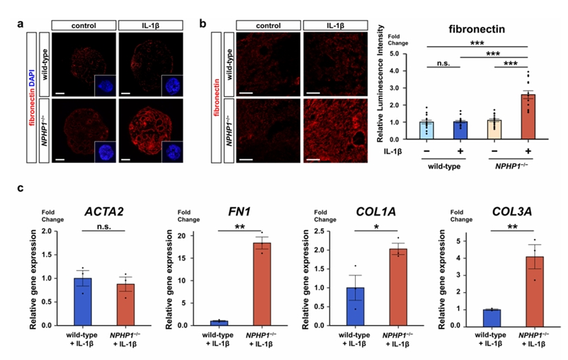 IL-1β对NPHP1缺陷型类器官纤维化的影响