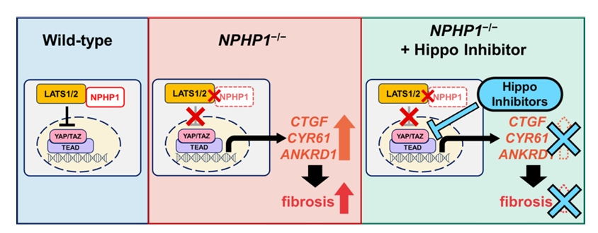 NPHP1缺失致纤维化的分子机制示意图