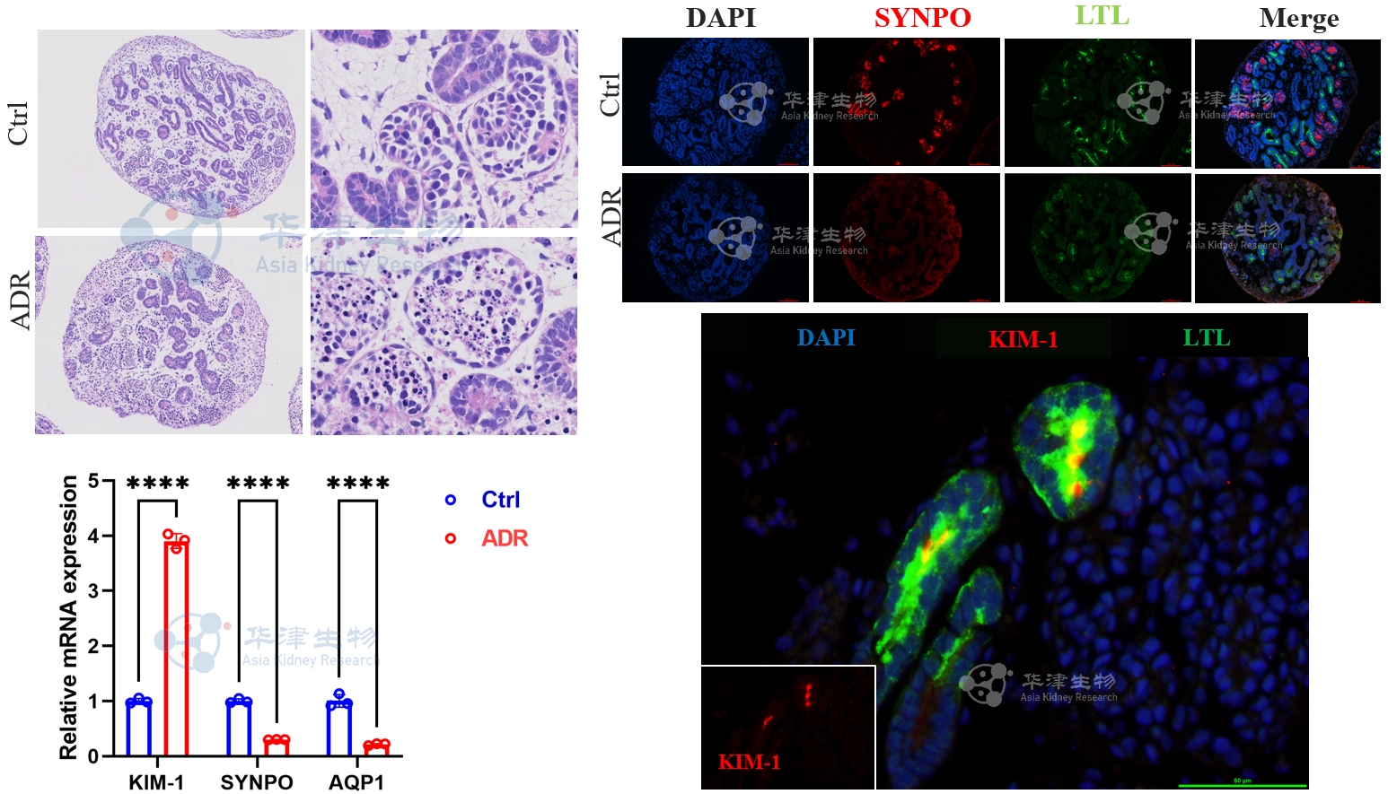 阿霉素诱导肾损伤类器官模型检测结果
