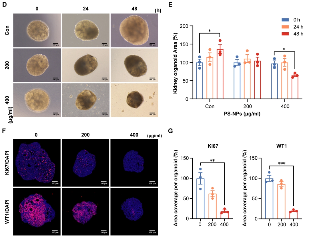 人肾脏类器官的培养及纳米塑料暴露对其的影响