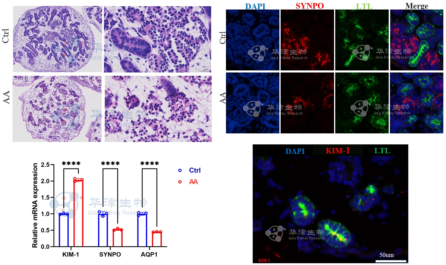 马兜铃酸刺激肾脏类器官检测结果