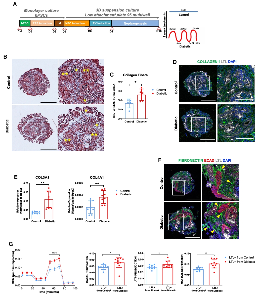 糖尿病类器官ACE2表达