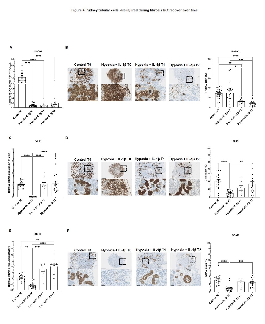肾类器官纤维化损伤后肾小球与肾小管差异性修复