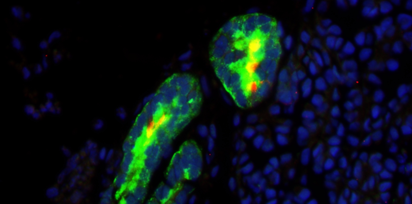 技术简介 | 华津kidnioid®阿霉素诱导肾损伤类器官模型