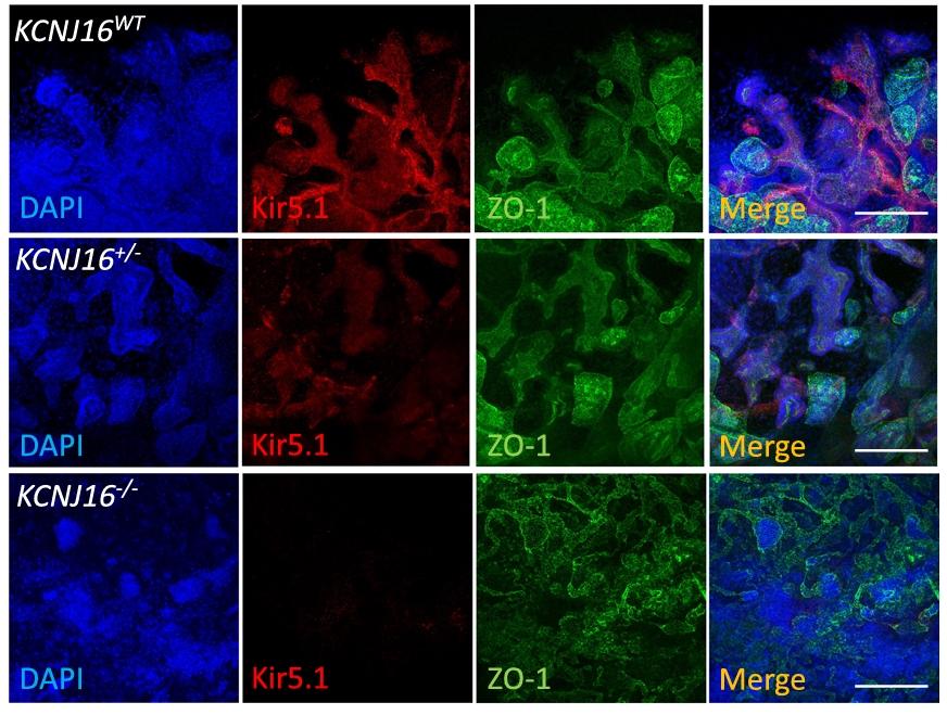 KCNJ16基因缺陷人iPSC来源肾脏类器官验证Kir5.1表达缺失