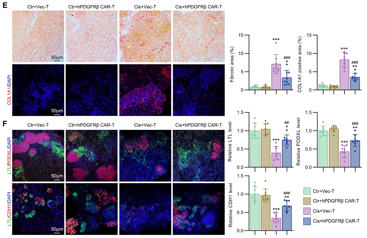 hPDGFRβ CAR-T细胞减轻肾脏类器官CKD模型中的肾小管间质纤维化