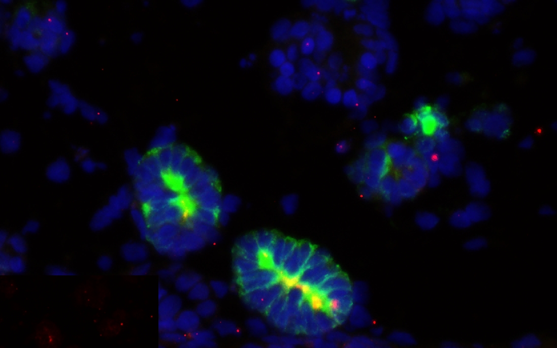 技术简介 | 华津kidnioid®马兜铃酸诱导肾损伤类器官模型