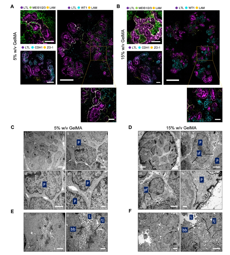 不同刚度GelMA水凝胶中肾类器官足细胞结构